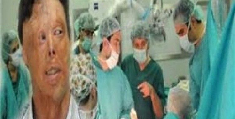 'Tam yüz naklini aşan ameliyat oldu'