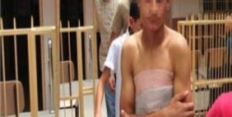 Polise molotof atarken kendini yaktı
