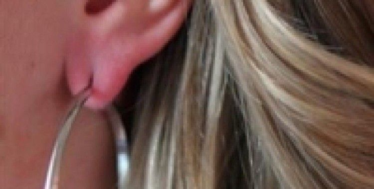 Büyük ve ağır hacimli küpeler kulaklara zarar veriyor