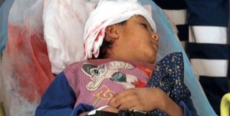Yola fırlayan Suriyeli çocuğa otomobil çarptı