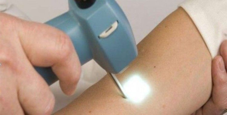 Vitiligo ile baş etmenin yolu güçlü bağışıklık sisteminden geçiyor