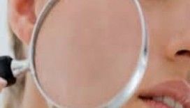  Rüyada cilt görmek ne demek ?