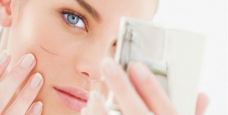  Rüyada çizik görmek