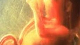  Rüyada çocuk düşürmek görmek