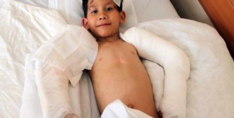 Altı yaşındaki çocuğun kopan kolu geri dikildi