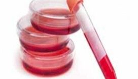 Rüyada kanı görmek