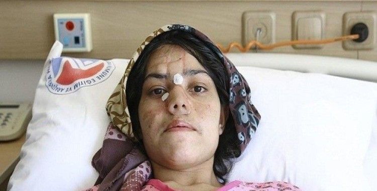 Afgan kadına Türkiye'de 'mucize' operasyon