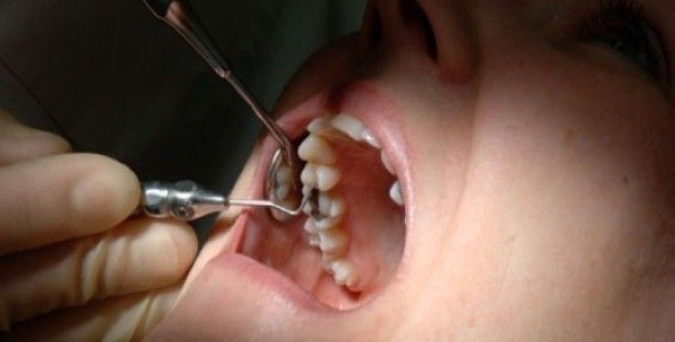 Çürük diş kalbe zarar veriyor