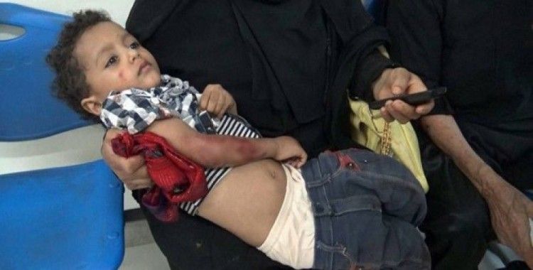 Yemen’de çatışma: 6 ölü, 20 yaralı
