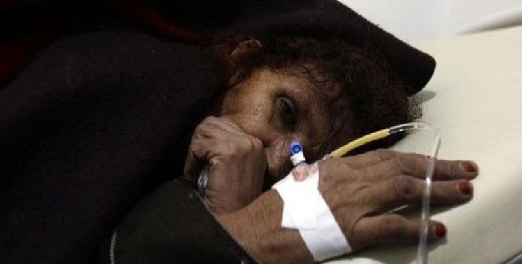 Yemen'deki kolera salgınında 2 bin 101 kişi hayatını kaybetti