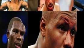 Boksörlerin ring öncesi ve sonrası fotoğrafları