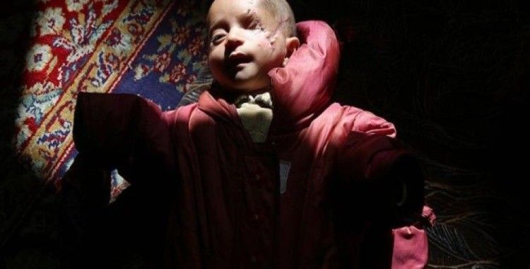 Doğu Gutalı öksüz bebeğin mucizevi direnişi sürüyor
