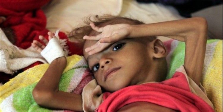 Yemenli çocuklar hayatta kalmak için üzüm yaprağı yiyor