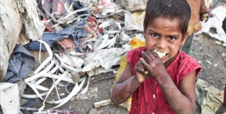 Yemen'de 2,2 milyon çocuk yetersiz beslenme sorunu yaşıyor