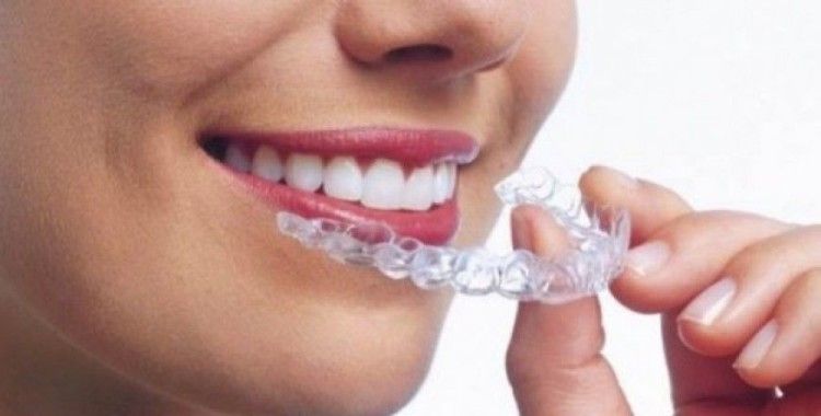Türkiye'de ilk kez görünmez diş teli üretildi