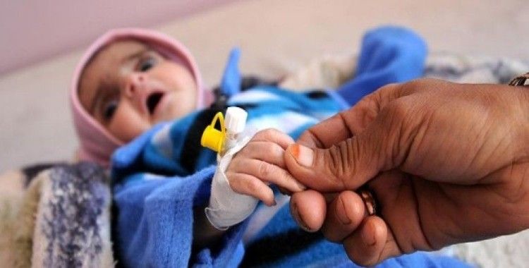 Yemen'de 10 dakikada 1 çocuk ölüyor
