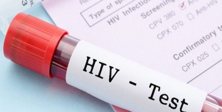 Türkiye'de HIV virüslü sayısında korkutan rakam
