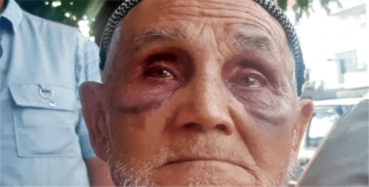 86 yaşındaki babasını darp eden zanlı tutuklandı