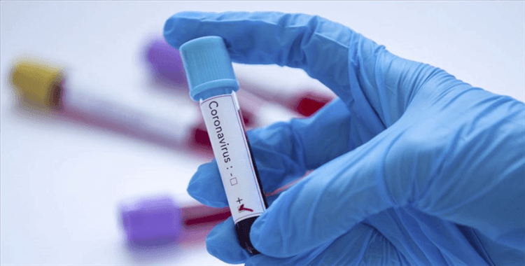 Sakarya'da 'koronavirüs testi' bahanesiyle dolandırıcılık operasyonu: 9 gözaltı