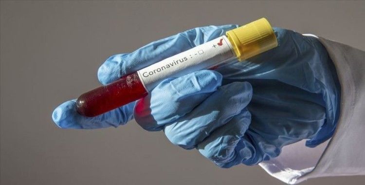 Mısır'da gemi turuna katılan Japonlarda koronavirüsü tespit edildi