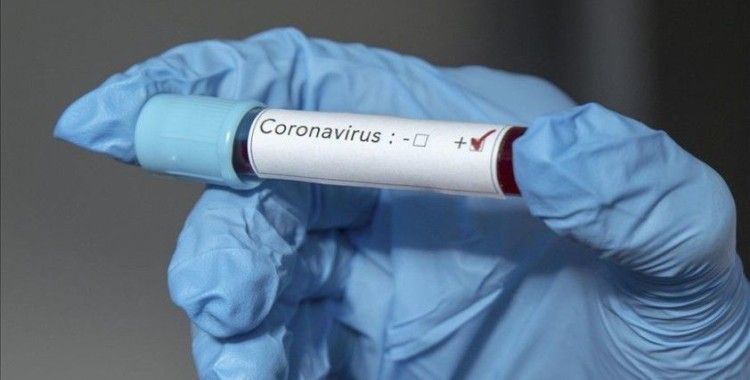 Portsmouth'ta 3 oyuncuda koronavirüs tespit edildi
