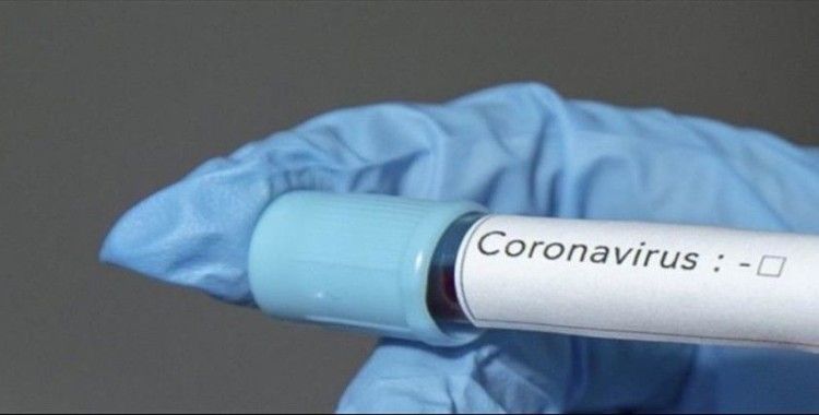 Azerbaycan'da 12 kişide daha koronavirüs tespit edildi