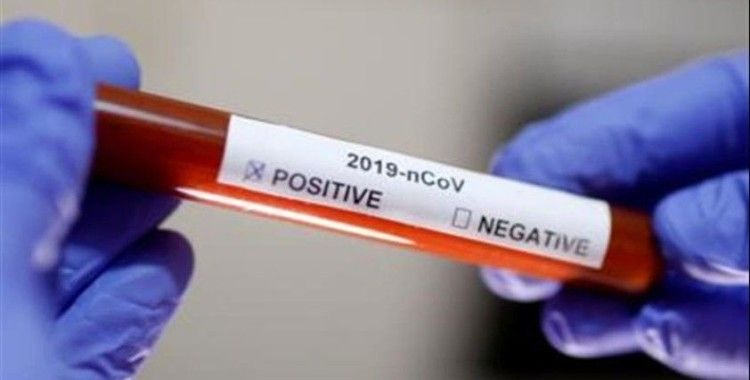 Ukrayna'da bir milletvekilinde daha koronavirüsü tespit edildi