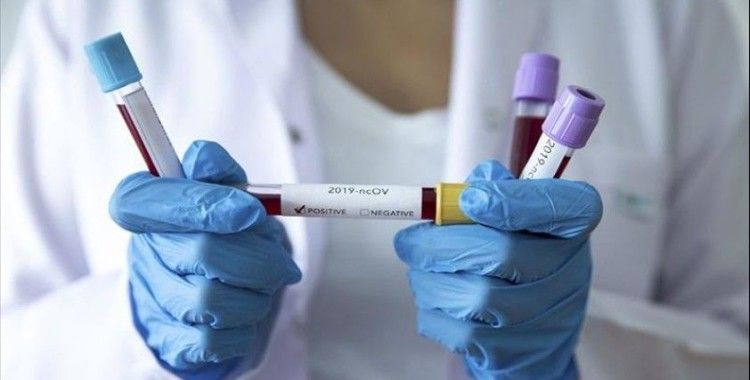 KKTC'de koronavirüs vakası 56'ya yükseldi