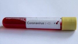 KKTC'de koronavirüsten ilk ölüm