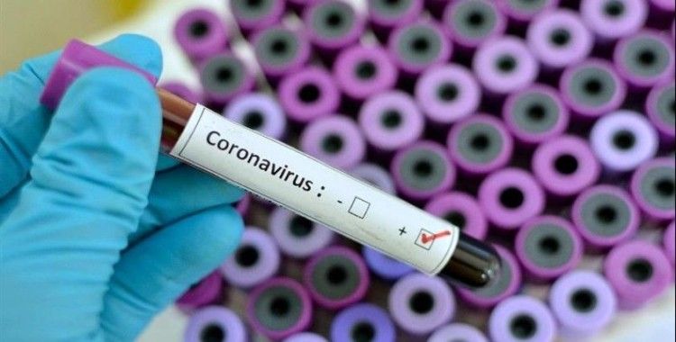 Rostech: Koronavirüs için taşınabilir hızlı test geliştiriyoruz