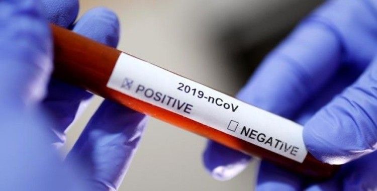 Japonya'da 4 kişi daha koronavirüsüne yenik düştü