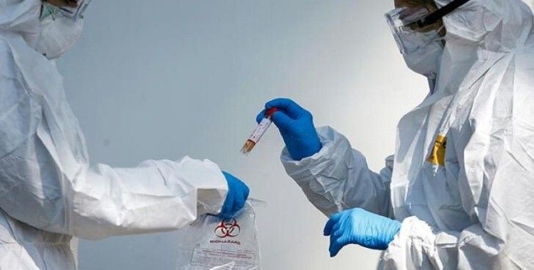 Rus epidemiyolog: Koronavirüsten daha tehlikelisi sırada olabilir