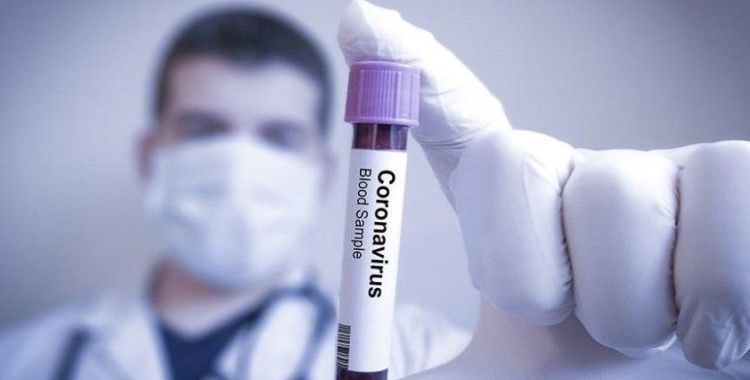 Yurt dışında koronavirüsten ölen Türklerin sayısı 156'ya yükseldi