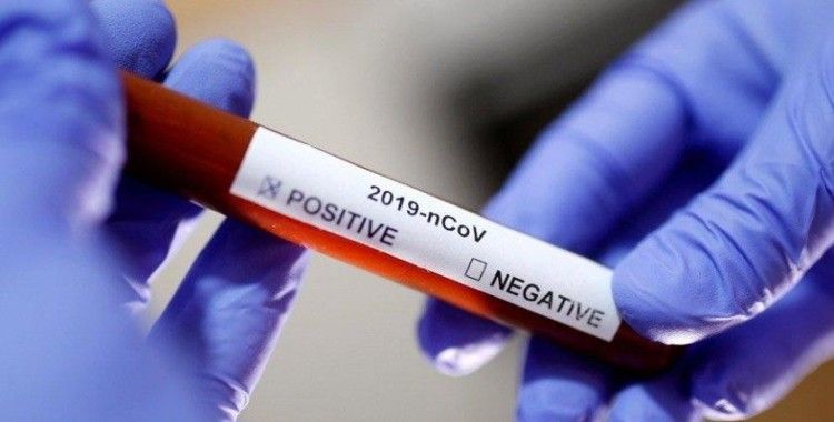 Interpol'den kritik Covid-19 uyarısı: Para için hedef alıyorlar