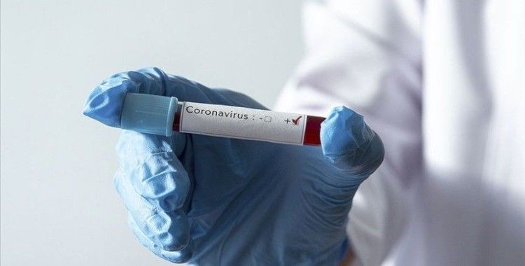 Rusya'da koronavirüs vakalarında rekor artış