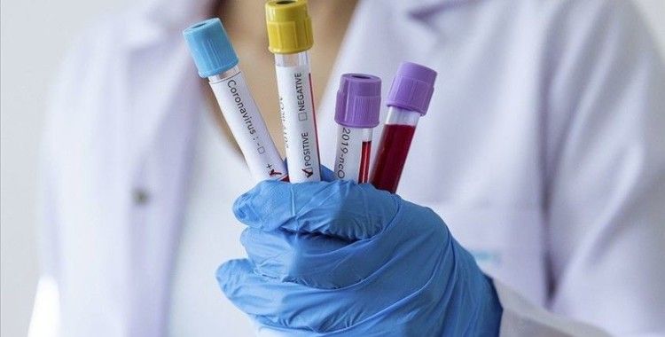 Türkiye'nin 'koronavirüs' istatistiği