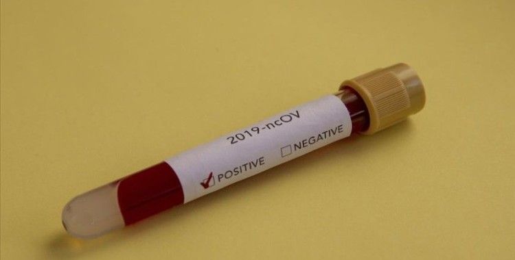 Korona için Remdesivir'in hastanelere dağıtımına başlandı