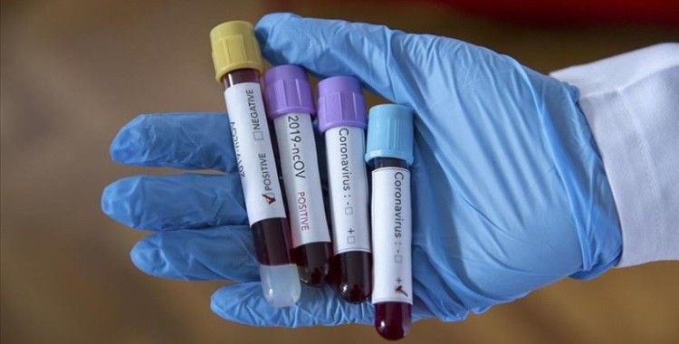 Kasımpaşa'da iki futbolcunun koronavirüs testi pozitif çıktı