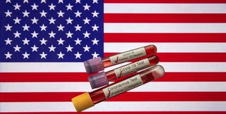ABD'de Türk vatandaşının geç tanı konulduğu için Kovid-19'dan yaşamını yitirdiği iddiası