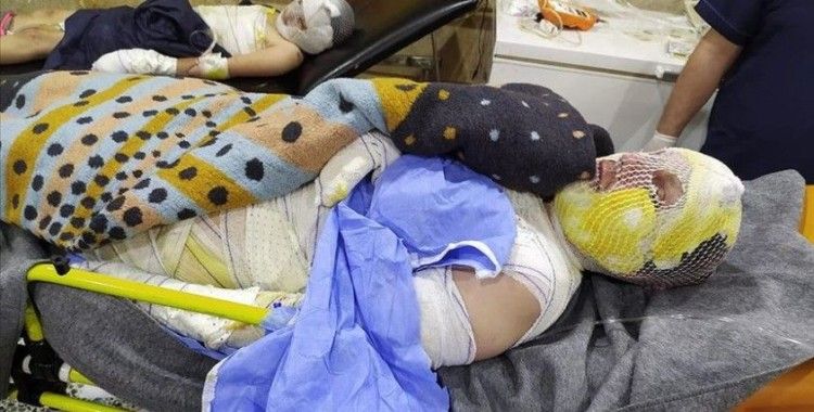 Yangında yaralanan Halepli aile yardım bekliyor