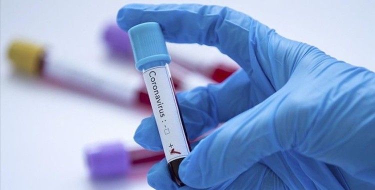 Polonya'da ilk kez son 24 saat içinde koronavirüsten ölüm gerçekleşmedi