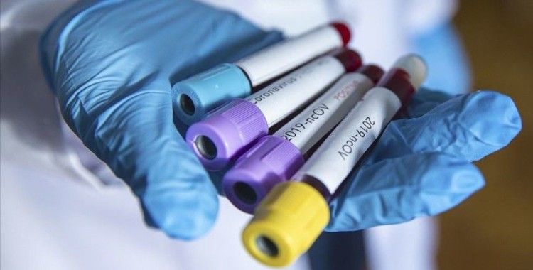 Almanya'da 289 yeni koronavirüs vakası tespit edildi