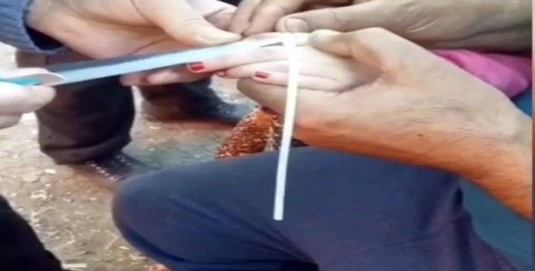  İstanbul’da parmağını sıkıştıran küçük kıza maket bıçaklı müdahale