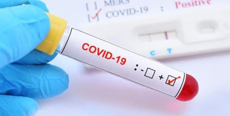 İstanbul'dan gelen 4 kişilik ailede koronavirüs tespit edildi