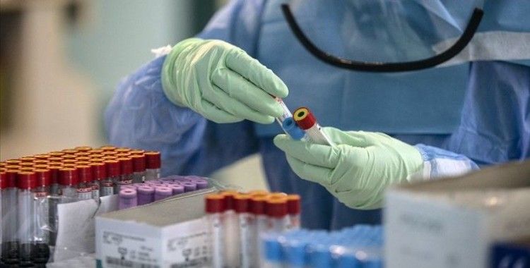 Kovid-19'un tiroit dokusuna karşı antikor fazlalığı oluşturduğu tespit edildi