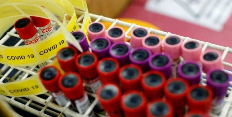 Araştırma: Covid-19'a karşı üretilen antikorlar kandan 2 ila 3 ay içinde siliniyor