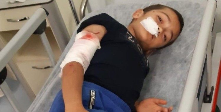 Sultangazi'de 10 yaşındaki çocuğa köpek saldırdı