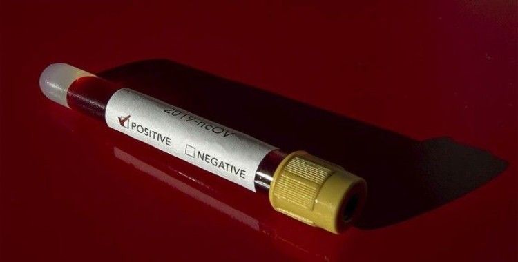 ABD'de Mississippi Eyaleti Temsilciler Meclisi Başkanı'nda Kovid-19 tespit edildi