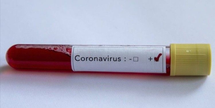 Sağlık çalışanı gelin ve damat düğünlerinde koronavirüse yakalandı