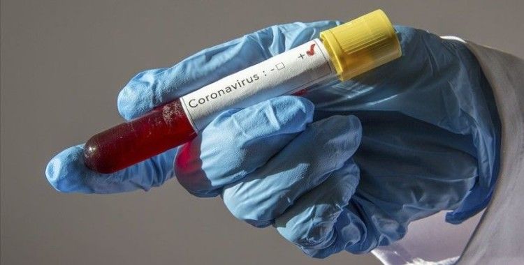 Fransa'da son 24 saatte 8 bin 577 koronavirüs vakası